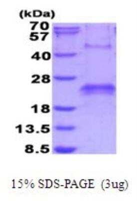 SDS-Page: Recombinant Human VEGF Protein [NBP2-53040] - 15% SDS-PAGE (3ug)