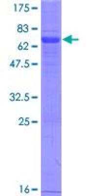 SDS-Page: Recombinant Human VISTA/B7-H5/PD-1H Protein [H00064115-P01] - 12.5% SDS-PAGE Stained with Coomassie Blue.