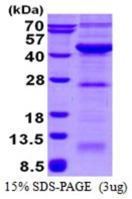 SDS-PAGE Recombinant Human VPS26A His Protein