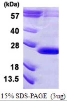 SDS-Page: Recombinant Human VPS29 Protein [NBP1-99036] - 15 % SDS-PAGE (3ug)