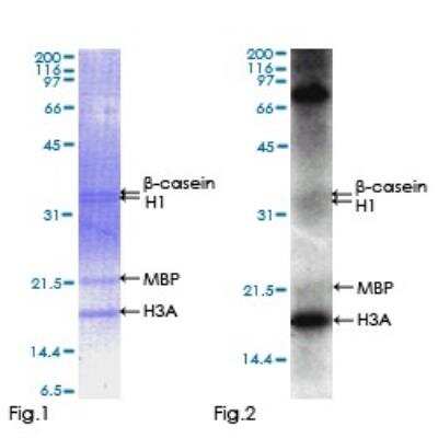 Functional: Recombinant Human VRK2 Protein [H00007444-P01]