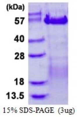 SDS-PAGE Recombinant Human VRK3 His Protein