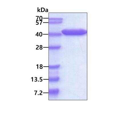 SDS-Page: Recombinant Human VTA1 His Protein [NBP1-99098] - 3ug by SDS-PAGE under reducing condition and visualized by coomassie blue stain.