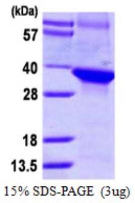 SDS-Page: Recombinant Human WDR68 Protein [NBP1-72421] - 15% SDS-PAGE (3ug)