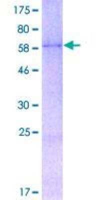 SDS-Page: Recombinant Human Wnt-2 Protein [H00007472-P01] - 12.5% SDS-PAGE Stained with Coomassie Blue.