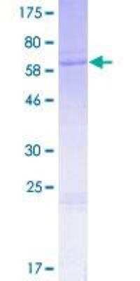 SDS-Page: Recombinant Human Wnt-6 Protein [H00007475-P01] - 12.5% SDS-PAGE Stained with Coomassie Blue.