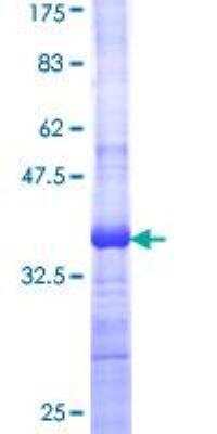SDS-Page: Recombinant Human Wnt-7b Protein [H00007477-Q01] - 12.5% SDS-PAGE Stained with Coomassie Blue.