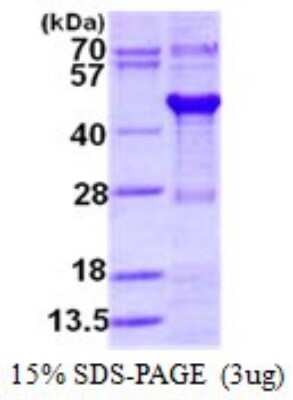 SDS-Page: Recombinant Human XAB1 Protein [NBP1-98928] - 15% SDS-PAGE (3ug)