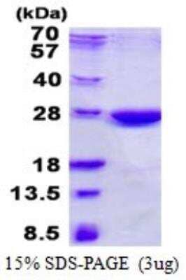 SDS-PAGE Recombinant Human XLF His Protein