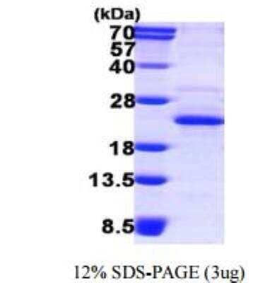 SDS-Page: Recombinant Human XTP3TPA Protein [NBP1-78880]