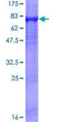 SDS-Page: Recombinant Human Xrn1 Protein [H00054464-P01] - 12.5% SDS-PAGE Stained with Coomassie Blue.