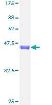 SDS-Page: Recombinant Human YSK4 Protein [H00080122-P01] - 12.5% SDS-PAGE Stained with Coomassie Blue.