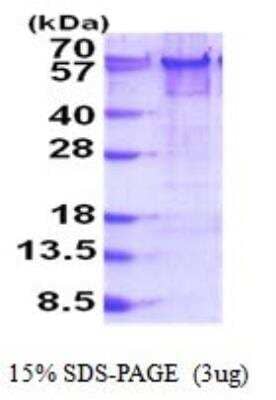 SDS-PAGE Recombinant Human YY1 His Protein