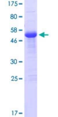 SDS-Page: Recombinant Human ZFAND2B Protein [H00130617-P01] - 12.5% SDS-PAGE Stained with Coomassie Blue.