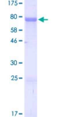 SDS-Page: Recombinant Human ZIC3 Protein [H00007547-P01] - 12.5% SDS-PAGE Stained with Coomassie Blue.