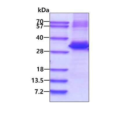 SDS-PAGE Recombinant Human ZNF313 His Protein