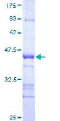 SDS-Page: Recombinant Human ZNFN1A4 Protein [H00064375-Q01] - 12.5% SDS-PAGE Stained with Coomassie Blue.