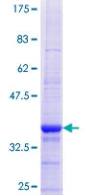 SDS-Page: Recombinant Human ZNHIT2 Protein [H00000741-Q01] - 12.5% SDS-PAGE Stained with Coomassie Blue.