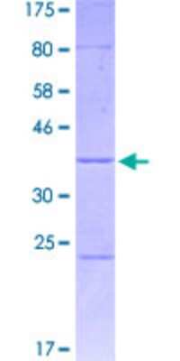 SDS-Page: Recombinant Human ZSCAN21/ZFP38 Protein [H00007589-Q01] - 12.5% SDS-PAGE Stained with Coomassie Blue.
