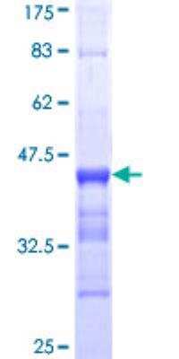 SDS-Page: Recombinant Human actin, gamma 2 Protein [H00000072-Q01] - 12.5% SDS-PAGE Stained with Coomassie Blue.