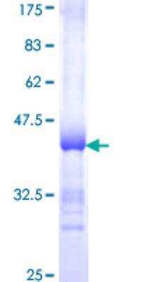 SDS-Page: Recombinant Human alcohol dehydrogenase 4 Protein [H00000127-Q01] - 12.5% SDS-PAGE Stained with Coomassie Blue.