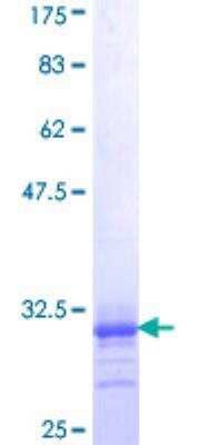 SDS-PAGE Recombinant Human alpha-1A Adrenergic R/ADRA1A GST (N-Term) Protein