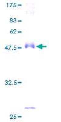SDS-Page: Recombinant Human alpha-Methylacyl-CoA Racemase/AMACR Protein [H00023600-P01] - 12.5% SDS-PAGE Stained with Coomassie Blue.
