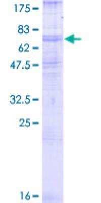 SDS-PAGE Recombinant Human beta-2 Adrenergic R/ADRB2 GST (N-Term) Protein