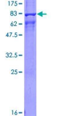 SDS-PAGE Recombinant Human beta-Arrestin 1 GST (N-Term) Protein