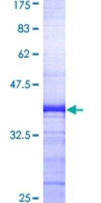 SDS-Page: Recombinant Human beta-Arrestin 2 Protein [H00000409-Q01] - 12.5% SDS-PAGE Stained with Coomassie Blue.