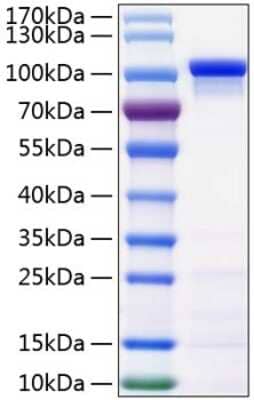 SDS-Page: Recombinant Human beta-Catenin His (C-Term) Protein [NBP3-18198] - Recombinant Human beta-Catenin Protein was determined by SDS-PAGE with Coomassie Blue, showing a band at 100-110 kDa.