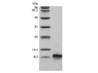 SDS-Page: Recombinant Human beta-Defensin 3 Protein [NBP2-34913]