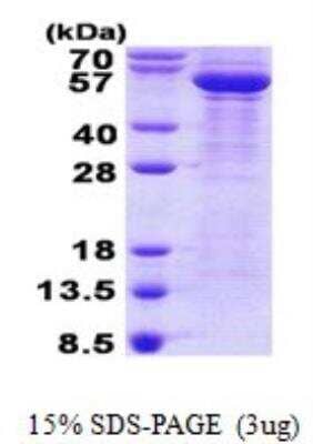 SDS-PAGE Recombinant Human beta-III Tubulin His Protein