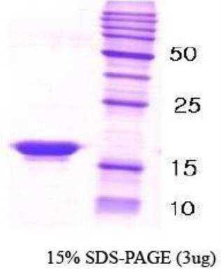 SDS-PAGE Recombinant Human beta-Synuclein Protein