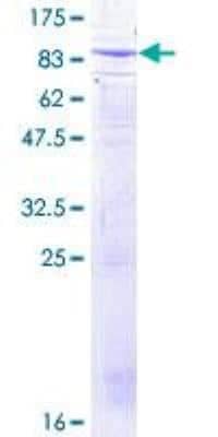 SDS-PAGE Recombinant Human beta-TrCP1/BTRC GST (N-Term) Protein