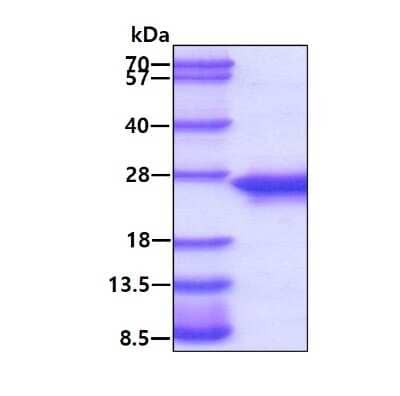 SDS-Page: Recombinant Human c-Myc-responsive protein Rcl Protein [NBP1-48353] - 3ug by SDS-PAGE under reducing condition and visualized by coomassie blue stain.