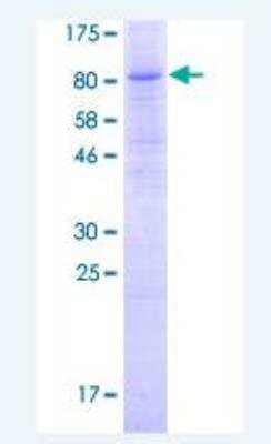 SDS-Page: Recombinant Human cGAS Protein [H00115004-P01-2ug] - 12.5% SDS-PAGE Stained with Coomassie Blue