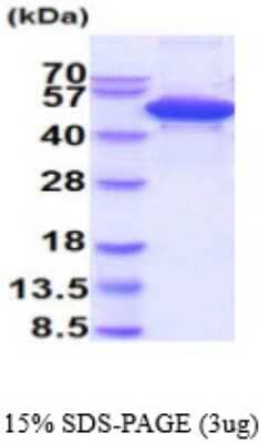 SDS-PAGE Recombinant Human cleavage stimulation factor His Protein