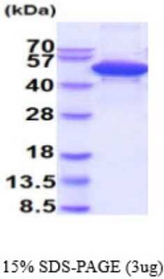 SDS-Page: Recombinant Human cleavage stimulation factor Protein [NBP2-59594] - 15% SDS-PAGE (3ug)