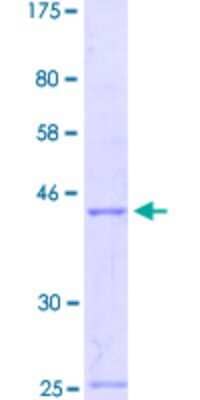 SDS-Page: Recombinant Human engrailed homeobox 2 Protein [H00002020-Q01] - 12.5% SDS-PAGE Stained with Coomassie Blue.