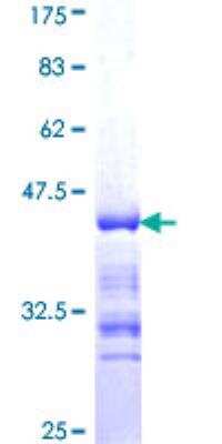 SDS-Page: Recombinant Human gamma Adducin Protein [H00000120-Q01] - 12.5% SDS-PAGE Stained with Coomassie Blue.