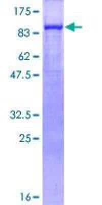 SDS-PAGE Recombinant Human gamma Catenin GST (N-Term) Protein