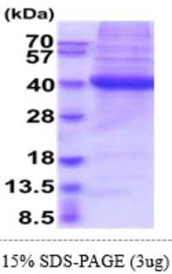 SDS-PAGE Recombinant Human CD1d His Protein