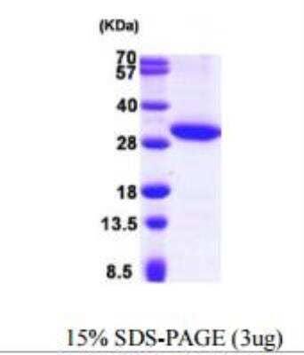 SDS-Page: Recombinant Human hydroxysteroid (17-beta) dehydrogenase 11 Protein [NBP1-50932] - 15% SDS-PAGE (3ug)