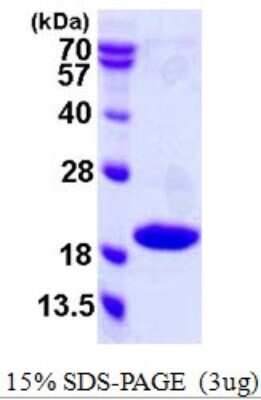 SDS-PAGE Recombinant Human p18INK4c/CDKN2C His Protein