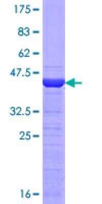 Recombinant Human p97/VCP Protein [H00007415-Q02] - 12.5% SDS-PAGE Stained with Coomassie Blue.