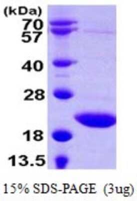 SDS-PAGE Recombinant Human sen15 His Protein