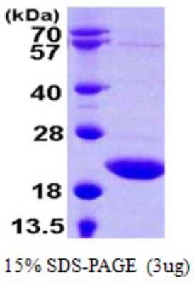 SDS-Page: Recombinant Human sen15 Protein [NBP1-72318] - 15% SDS-PAGE (3ug)