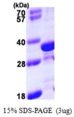SDS-Page: Recombinant Human tropomyosin-4 Protein [NBP1-51062] - 15 % SDS-PAGE (3ug)