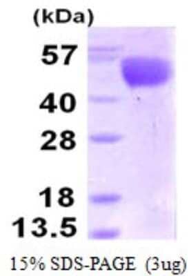 Western Blot: Recombinant Influenza A Virus H3N2 Influenza A H3N2 Hemagglutinin (A/Perth/16/2009) His Protein [NBP1-99044] - 15% SDS-PAGE (3ug)